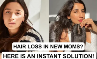 Hair loss in new moms? Here is an instant solution!