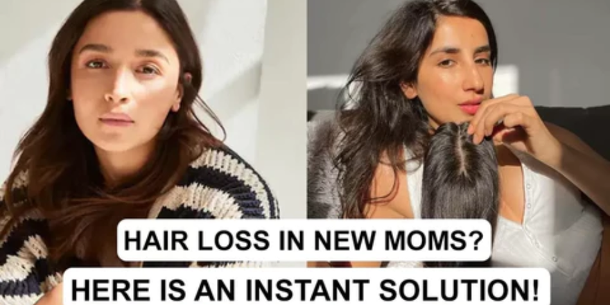 Hair loss in new moms? Here is an instant solution!