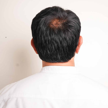 Men Hair Toupée | Pre Cut - Silk Base Most Natural Looking | Nish Hair